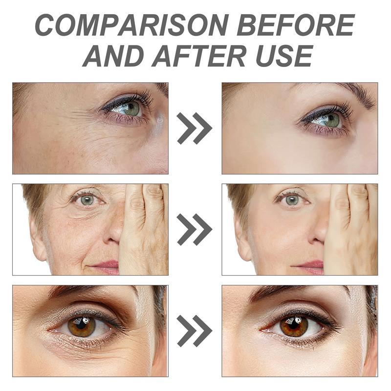 Retinol Remove Wrinkle Face Se - The Ordinary Serum Hyaluronic Acid 评论和价格