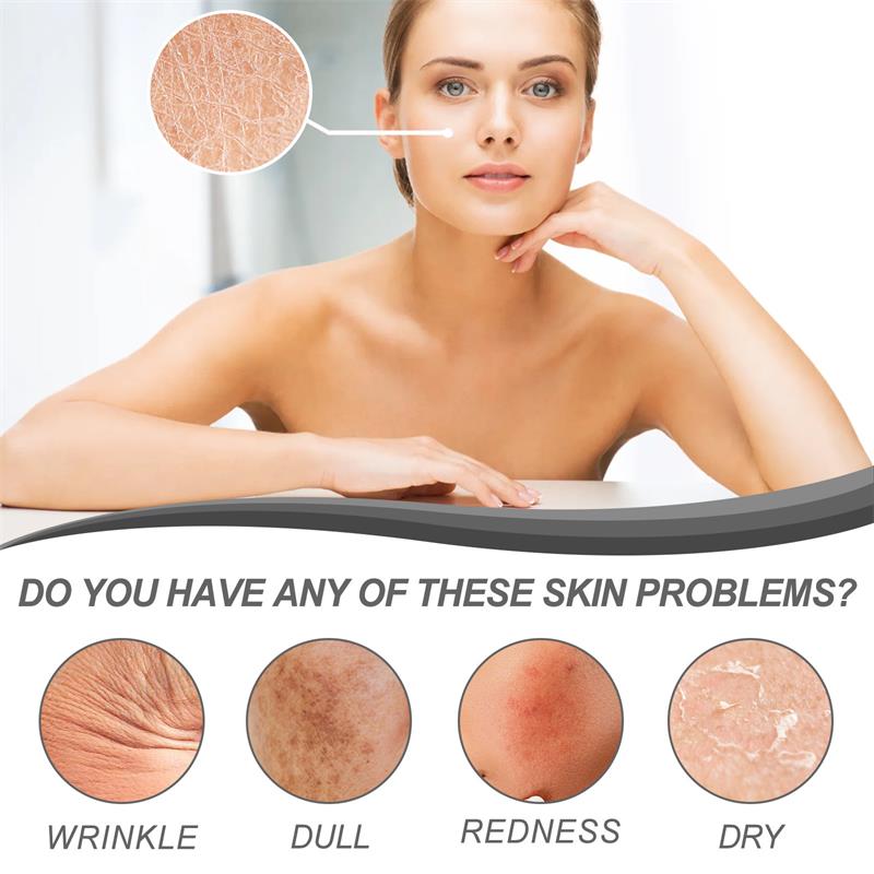 Retinol Remove Wrinkle Face Se - The Ordinary Serum Hyaluronic Acid 评论和价格